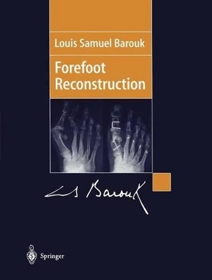Forefoot Reconstruction - Louis S. Barouk
