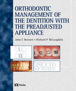 Orthodontic Management of the Dentition with the Pre-adjusted Appliance - John C. Bennett, Richard P. McLaughlin