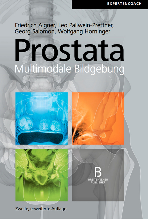 Prostata – Multimodale Bildgebung - 