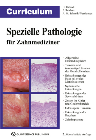 Curriculum Spezielle Pathologie für Zahnmediziner - Harald Ebhardt; Peter A. Reichart …