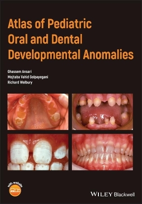 Atlas of Pediatric Oral and Dental Developmental Anomalies - Ghassem Ansari, Mojtaba Vahid Golpayegani, Richard Welbury