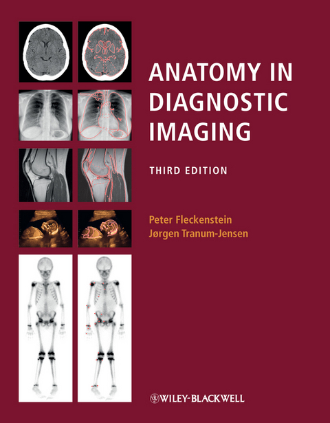 Anatomy in Diagnostic Imaging -  Peter Fleckenstein,  J rgen Tranum-Jensen