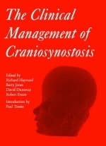 Clinical Management of Craniosynostosis - 