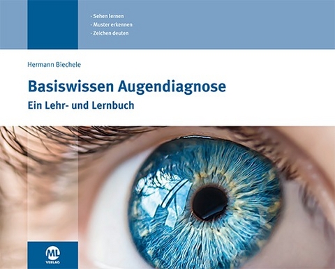 Basiswissen Augendiagnose - Hermann Biechele, Andreas Beutel
