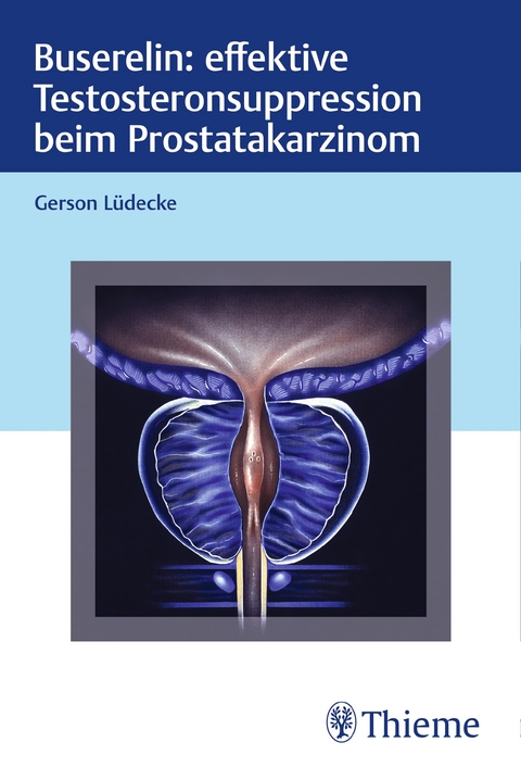 Buserelin: effektive Testosteronsuppression beim Prostatakarzinom - Gerson Lüdecke