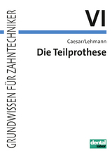 Grundwissen für Zahntechniker / Die Teilprothese - Caesar, H Hans; Lehmann, Klaus M