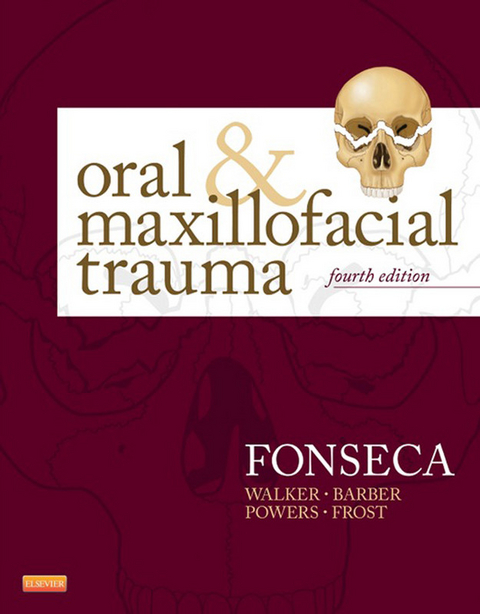 Oral and Maxillofacial Trauma -  H. Dexter Barber,  Raymond J. Fonseca,  David E. Frost,  Michael P. Powers