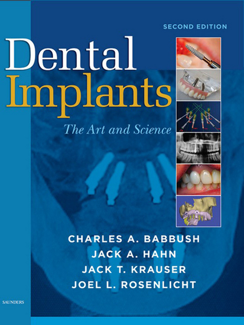 Dental Implants -  Charles A. Babbush,  Jack A. HAHN,  Jack T. KRAUSER,  Joel L. ROSENLICHT