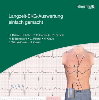 Langzeit-EKG-Auswertung einfach gemacht - Helma Dehn; Heike Löhr; Faiza El-Hamouti …