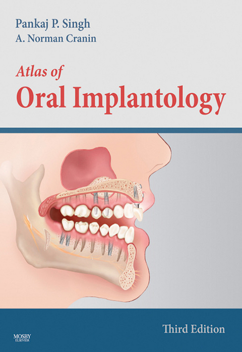 Atlas of Oral Implantology - E-Book -  A. Norman Cranin,  Pankaj Singh
