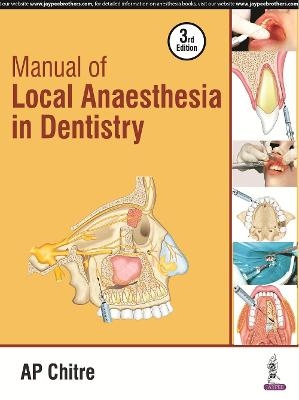 Manual of Local Anaesthesia in Dentistry - AP Chitre