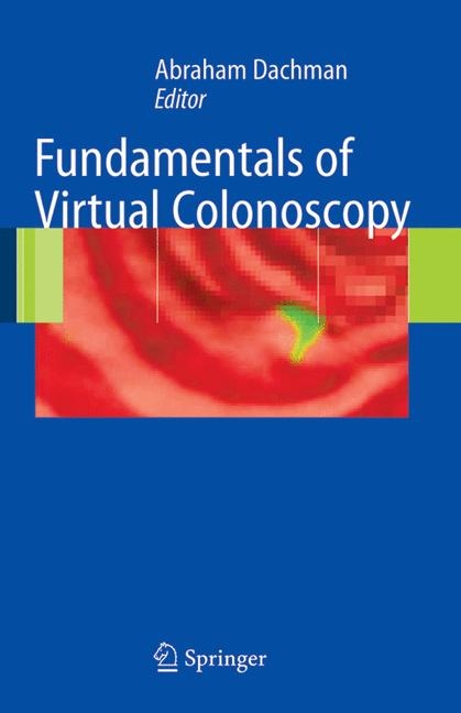 Fundamentals of Virtual Colonoscopy - 