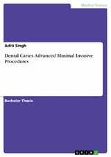 Dental Caries. Advanced Minimal Invasive Procedures - Aditi Singh