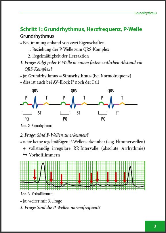 EKG-Befund-in-5-Schritten - Seite 3