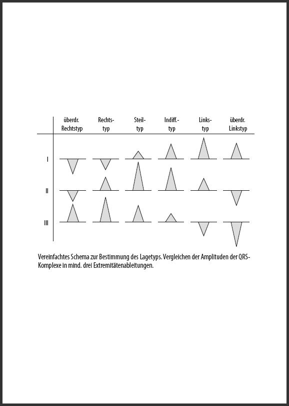 EKG-Befund-in-5-Schritten - Seite 5