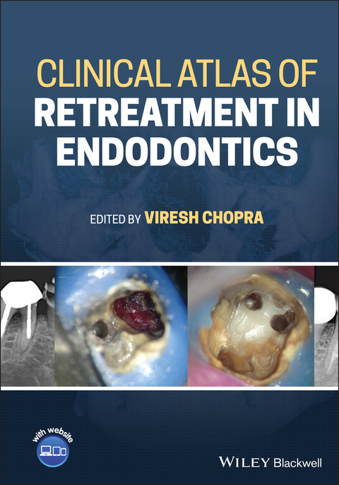 Clinical Atlas of Retreatment in Endodontics - 