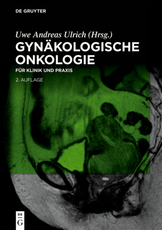 Gynäkologische Onkologie - Uwe Andreas Ulrich