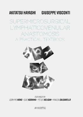 Supermicrosurgical LymphaticoVenular Anastomosis - 