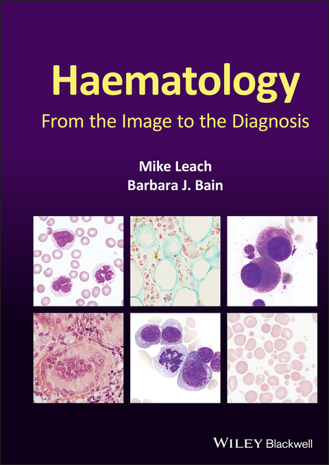 Haematology - Mike Leach, Barbara J. Bain