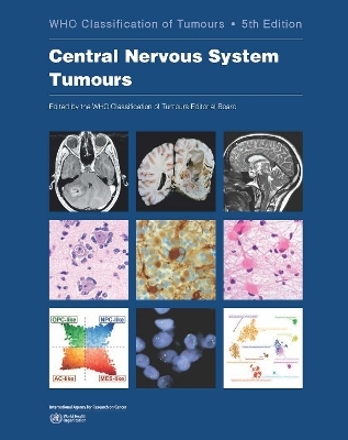 WHO classification of tumours of the central nervous system -  International Agency for Research on Cancer