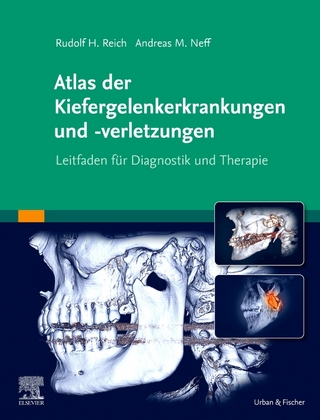Atlas Kiefergelenkerkrankungen und -verletzungen - Rudolf H. Reich
