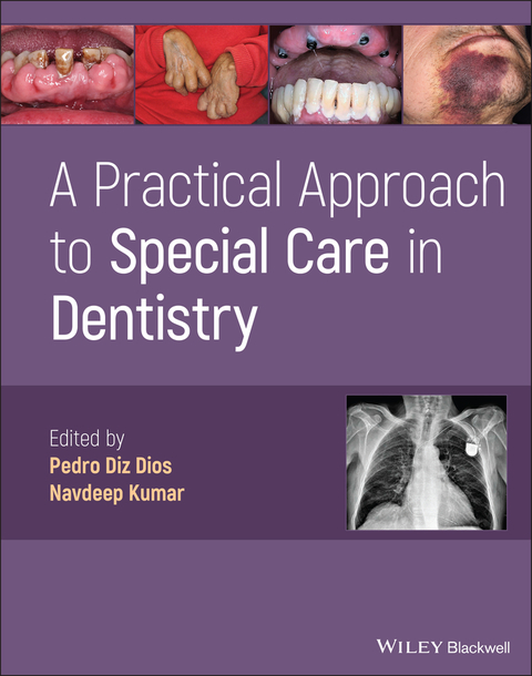 A Practical Approach to Special Care in Dentistry - 