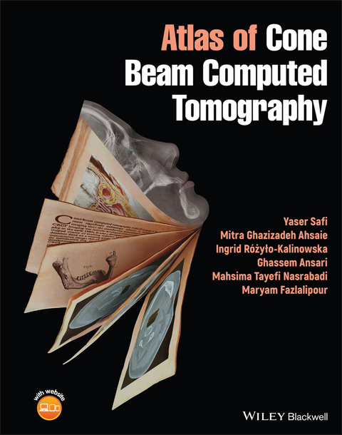 Atlas of Cone Beam Computed Tomography - Yaser Safi, Mitra Ghazizadeh Ahsaie, Ingrid Rozylo-Kalinowska, Ghassem Ansari, Mahsima Tayefi Nasrabadi