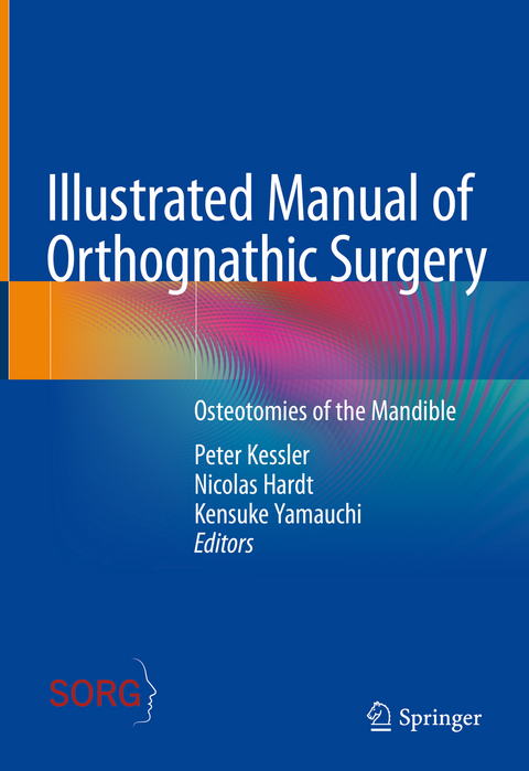 Illustrated Manual of Orthognathic Surgery - 