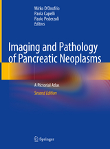 Imaging and Pathology of Pancreatic Neoplasms - D'Onofrio, Mirko; Capelli, Paola; Pederzoli, Paolo