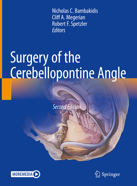 Surgery of the Cerebellopontine Angle - 
