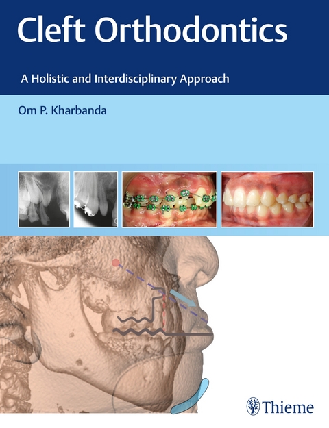 Cleft Orthodontics - Om P. Kharbanda