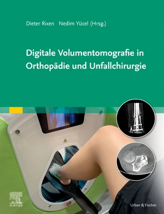 Digitale Volumentomografie in Orthopädie und Unfallchirurgie - Dieter Rixen; Nedim Yücel