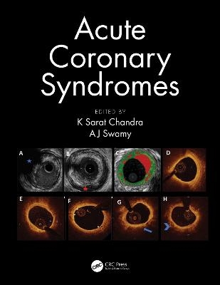 Acute Coronary Syndromes - 