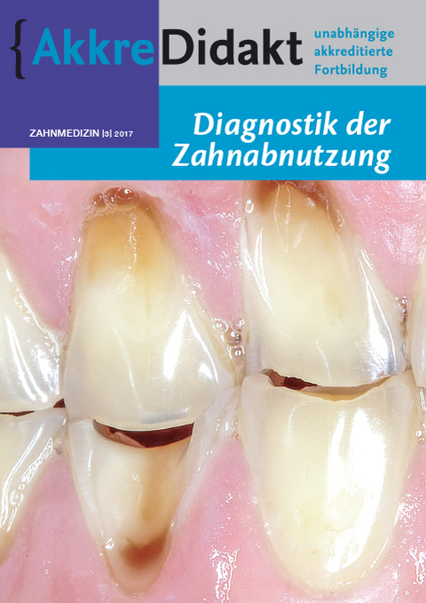 Diagnostik der Zahnabnutzung - Peter Wetselaar, Frank Lobbezoo
