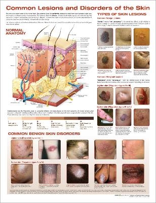 Common Lesions and Disorders of the Skin Anatomical Chart - 