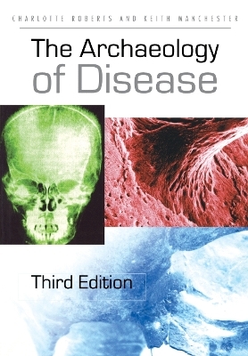 The Archaeology of Disease - Charlotte Roberts; Keith Manchester