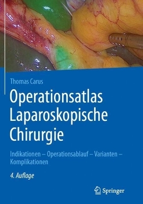 Operationsatlas Laparoskopische Chirurgie - Thomas Carus