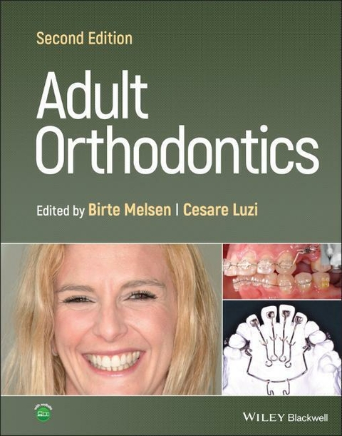 Adult Orthodontics - Birte Melsen, Cesare Luzi