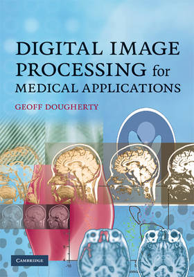 Digital Image Processing for Medical Applications -  Geoff Dougherty