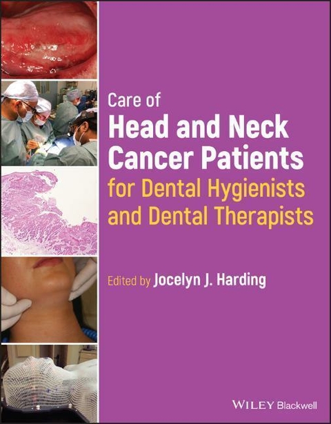 Care of Head and Neck Cancer Patients for Dental Hygienists and Therapists - 