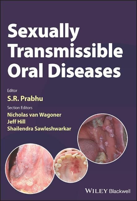 Sexually Transmissible Oral Diseases - 
