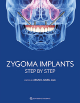 Zygoma Implants - Arun K Garg