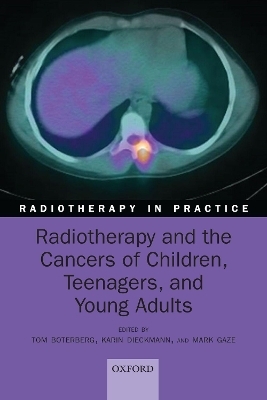 Radiotherapy and the Cancers of Children, Teenagers, and Young Adults - 