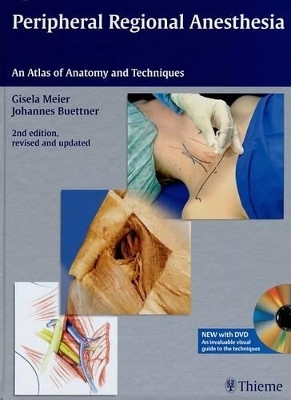 Peripheral Regional Anesthesia - Gisela Meier, Johannes Buettner
