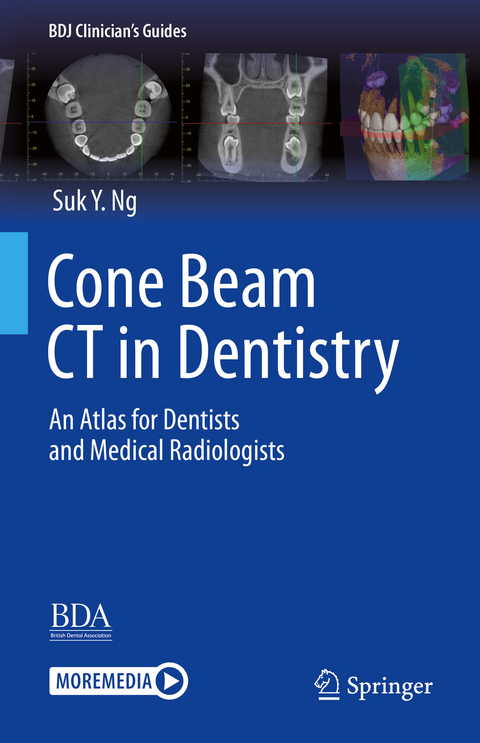 Cone Beam CT in Dentistry - Suk Yee Ng