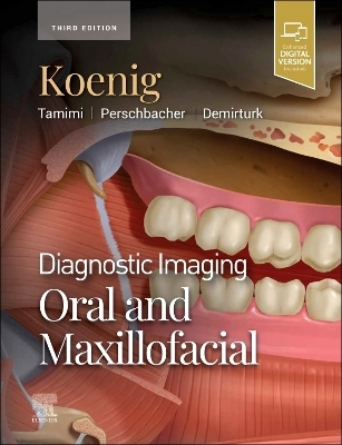 Diagnostic Imaging: Oral and Maxillofacial - Lisa J. Koenig, Dania Tamimi, Susanne E. Perschbacher, Husniye Demirturk