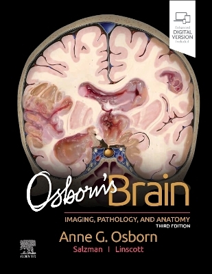 Osborn's Brain - Anne G. Osborn, Luke L. Linscott, Karen L. Salzman