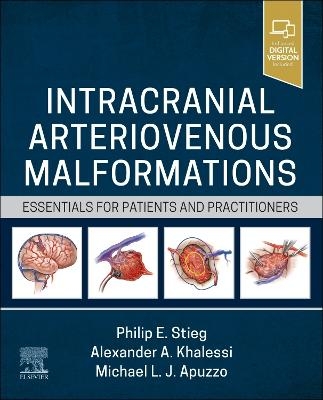 Intracranial Arteriovenous Malformations - 