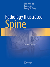 Radiology Illustrated: Spine - Lee, Joon Woo; Lee, Eugene; Kang, Heung Sik