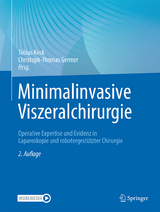 Minimalinvasive Viszeralchirurgie - Keck, Tobias; Germer, Christoph-Thomas
